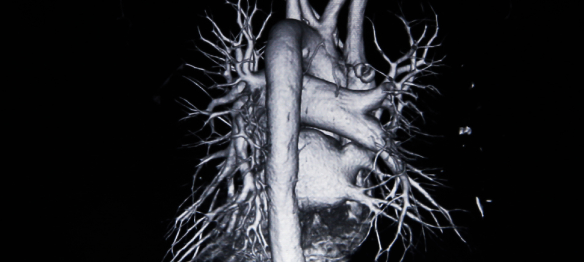 ※磁気共鳴血管画像サンプル画像